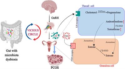 Effects of intestinal flora on polycystic ovary syndrome